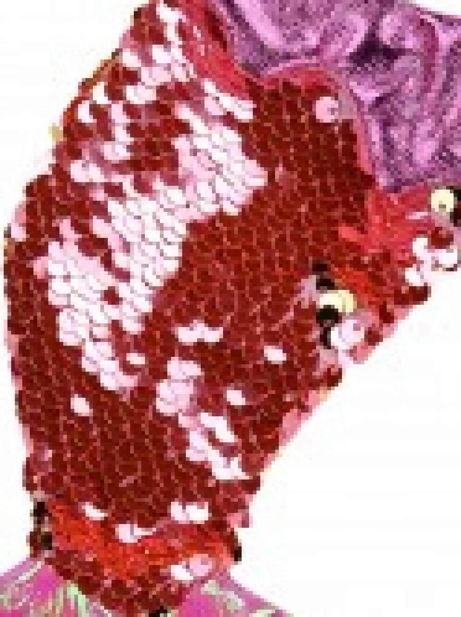 Christmas Warehouse Mini Mermaid Tail With Pink Sequins Christmas Stockings - 3 X 20Cm> Christmas Stockings
